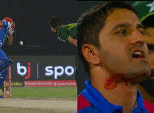 Najibullah Zadran's jaw narrowly avoided breaking on Ihsanullah's 147 km stormy ball, blood-soaked, painful scene